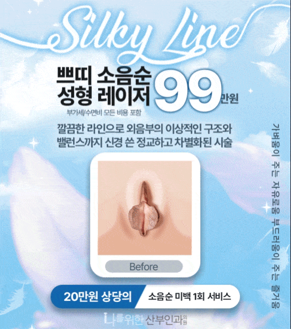 쁘띠 소음순 성형 레이저