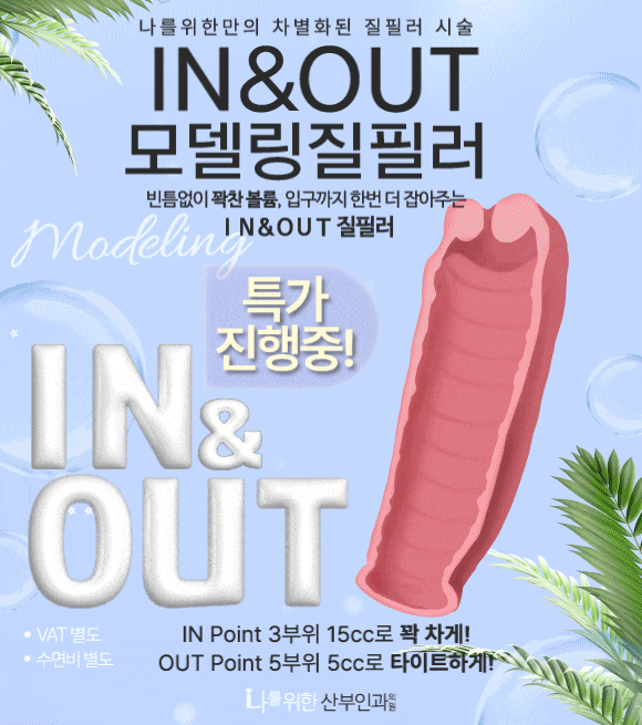  IN&OUT 모델링 질필러